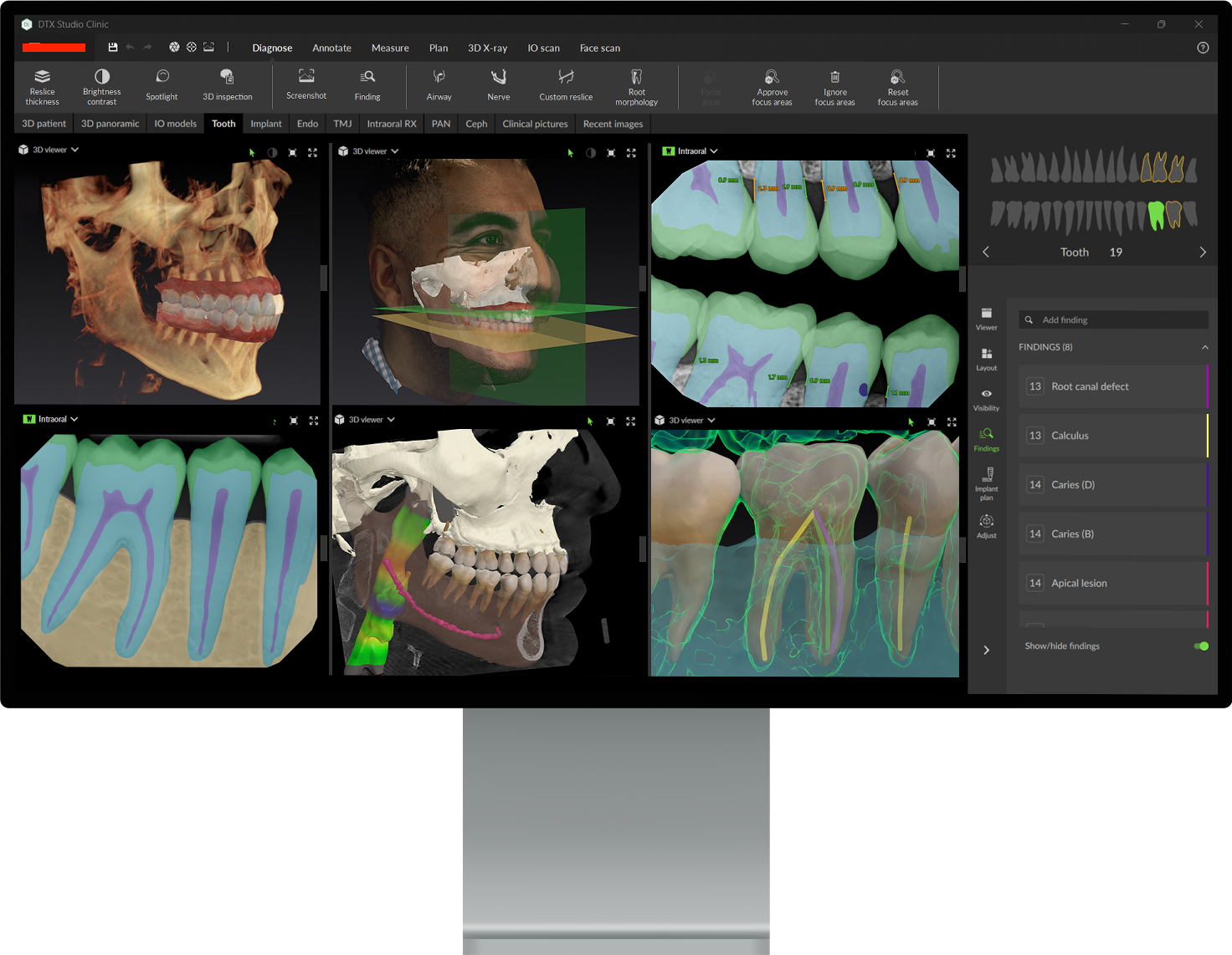 CBCT & Digital X-Rays