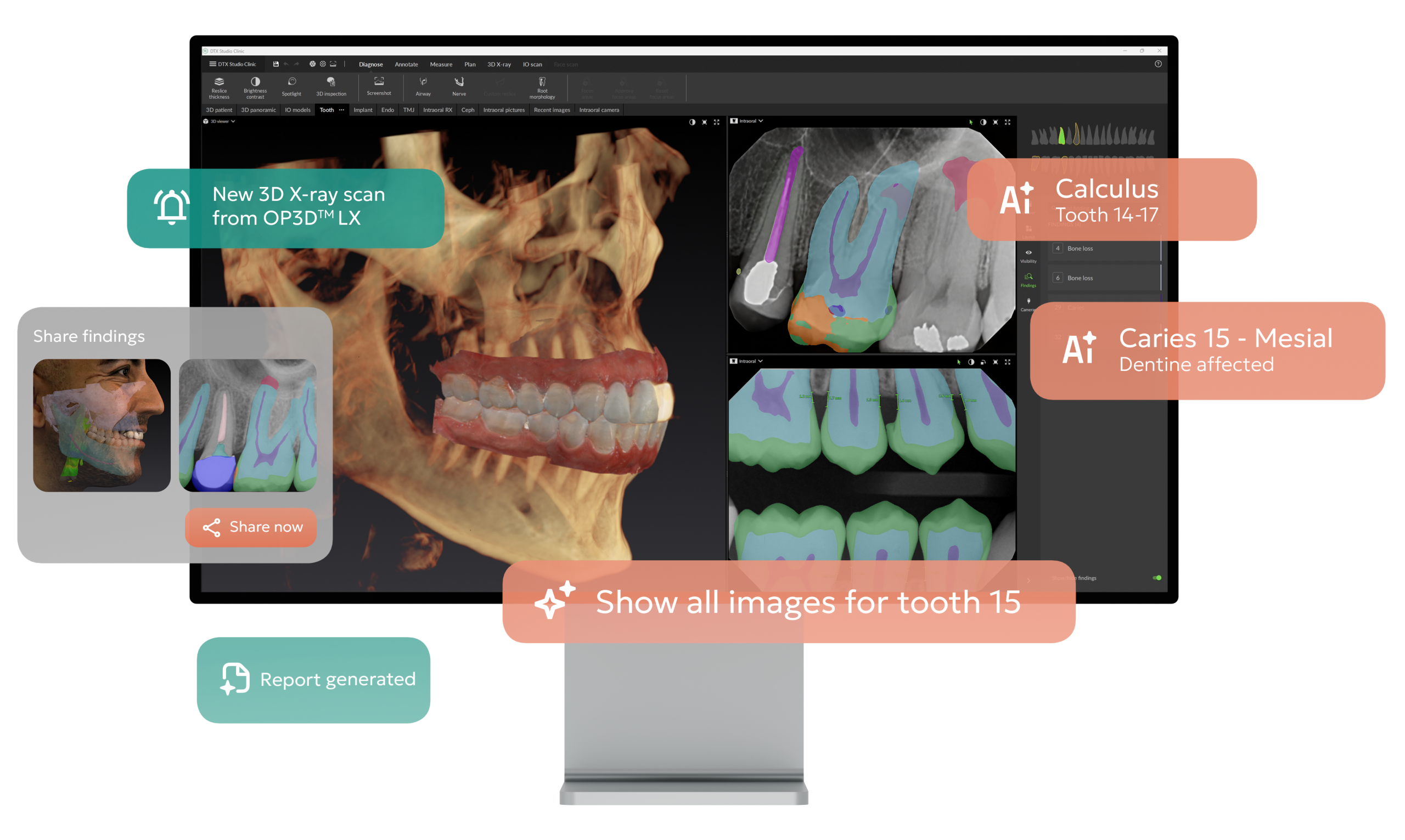 Ai Assisted Diagnostics