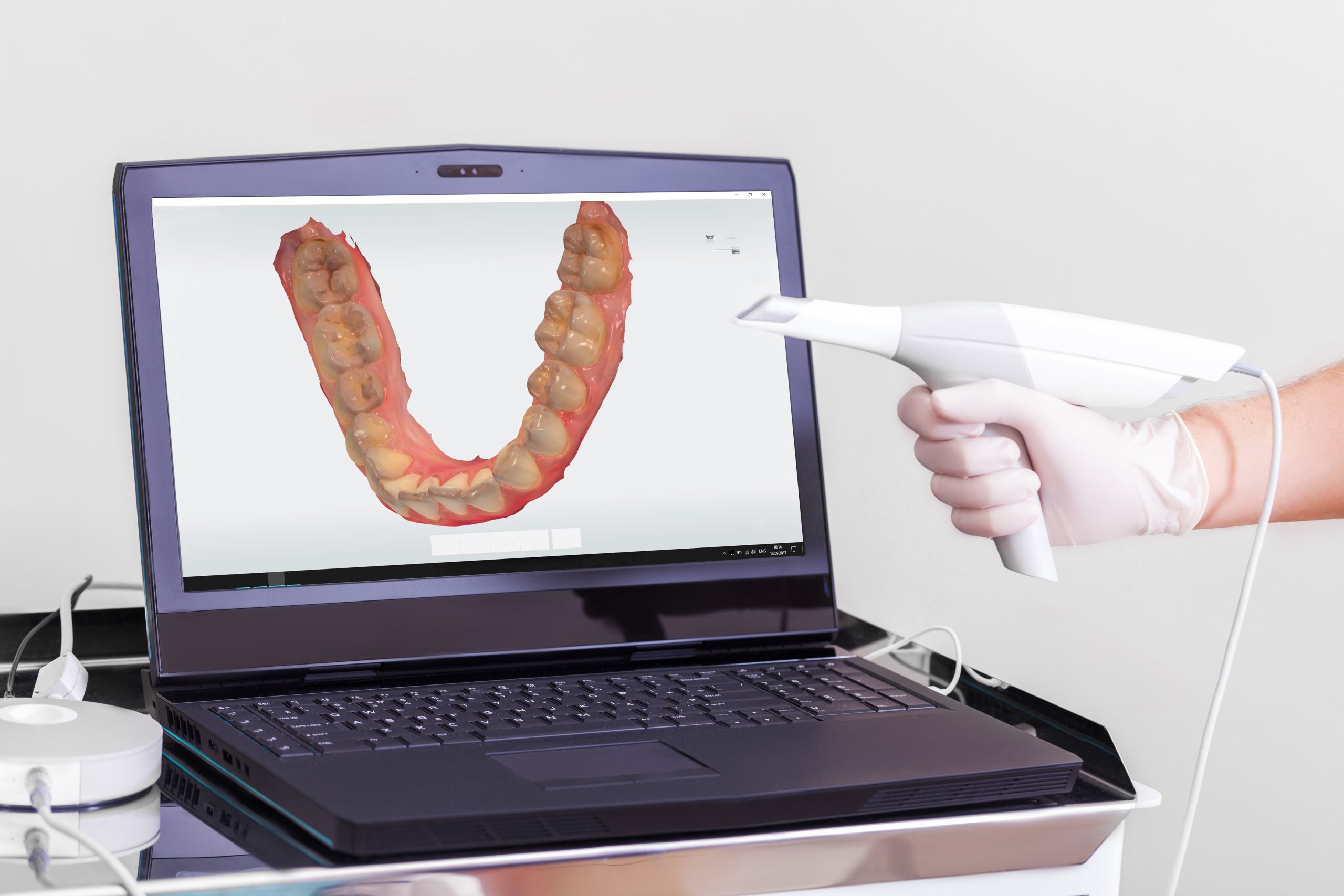 Intraoral Scanner and Smile Design Software